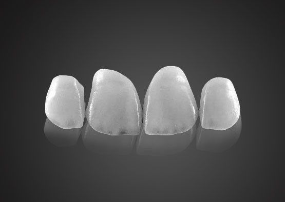IPS 0.2 मिमी अल्ट्रा पतला Emax veneers उच्च शक्ति के साथ दाग प्रतिरोधी